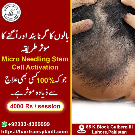 Best Hair fall solution Lahore