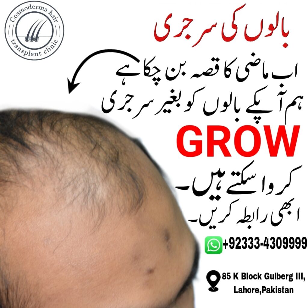 Best Hair loss Lahore clinic