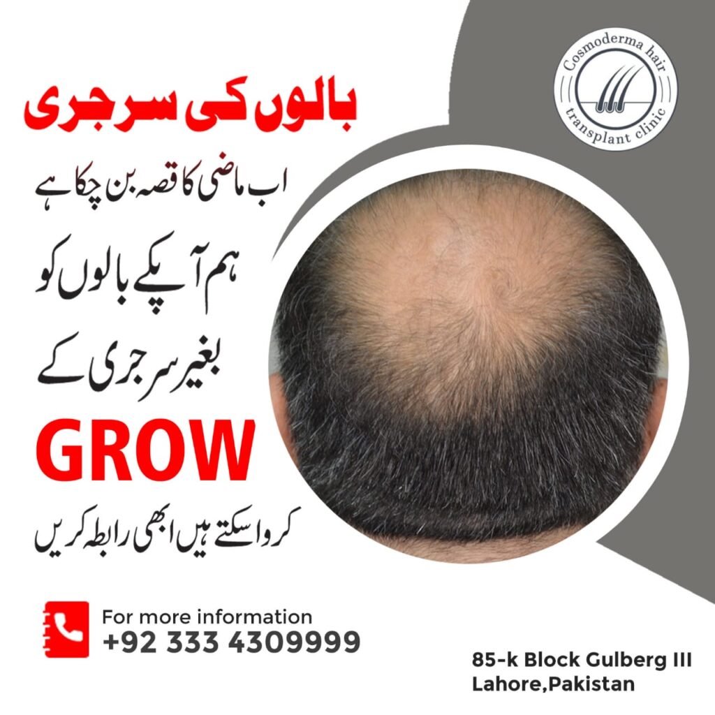 Best genetic hair loss treatment